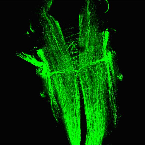 Fluorescence confocal microscopy image of a hindbrain of a Xenopus laevis (frog) using DSHB antibody 3A10 showing Mauthner cells and other reticular neurons. Image Credit: Karen Thompson.